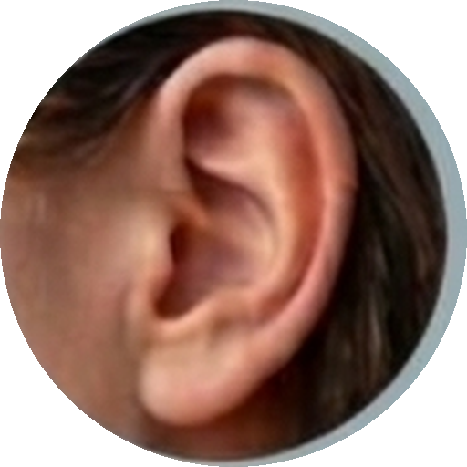 Hearing loss